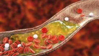 Lima Sayuran Ini Manjur Turunkan Kolesterol